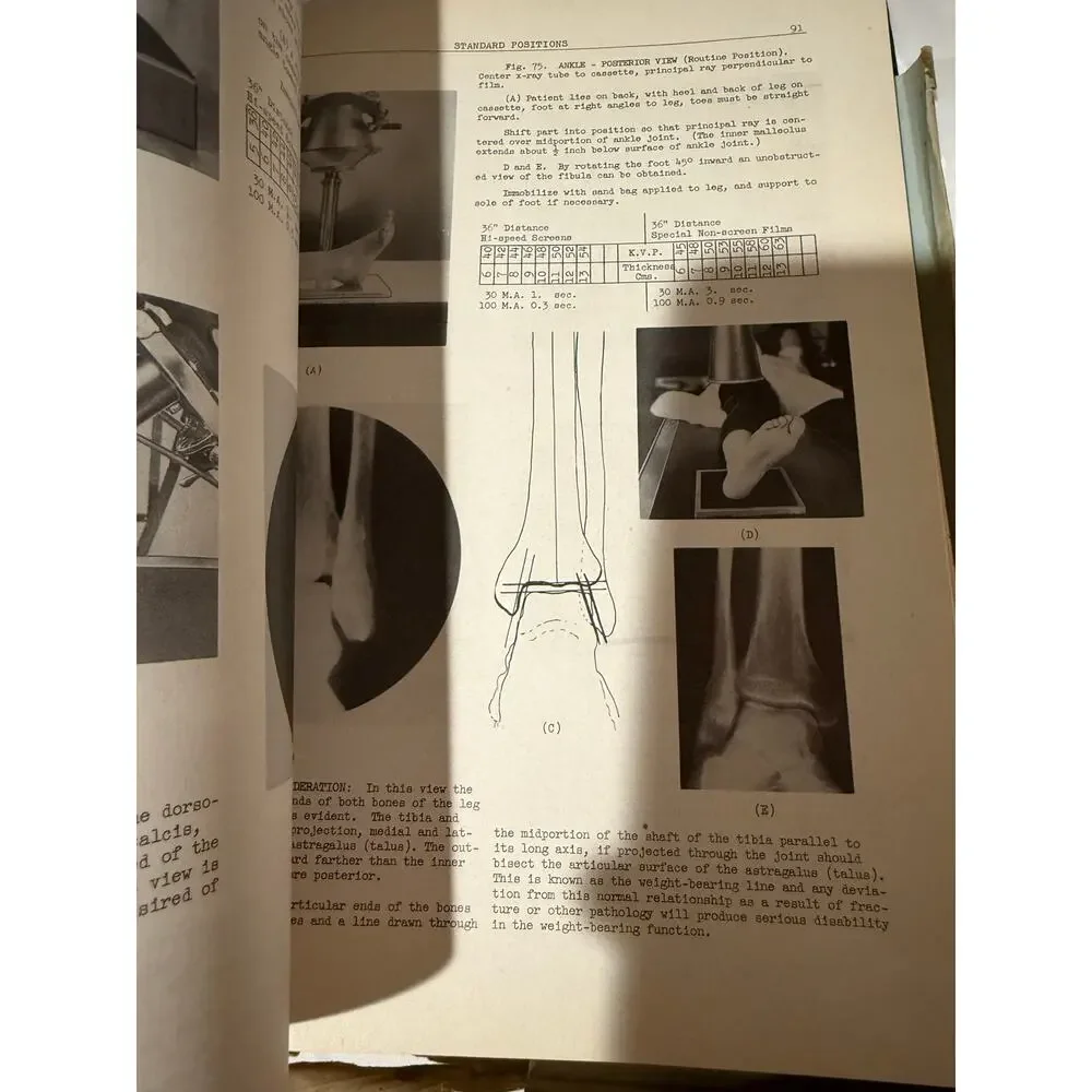 Manual of Roentgenological Technique by L.R. Sante - 1942 Hardcover w/DJ